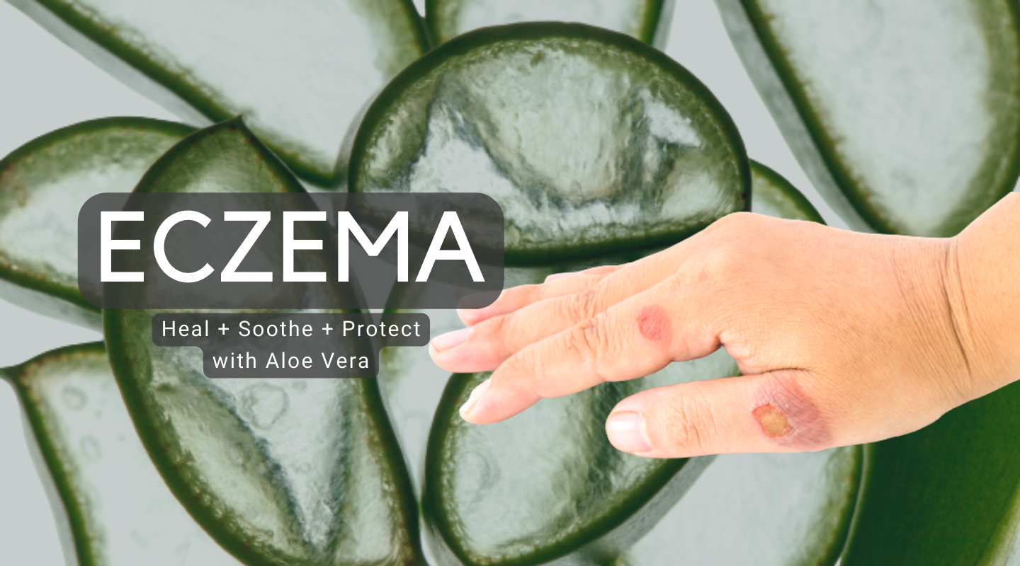 Nutzen Sie die Kraft der Aloe Vera: Eine natrliche Lsung gegen Ekzeme