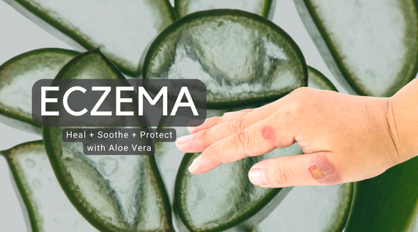 Aloe Vera for Eczema Relief - Buy Curaloe Aloe Vera Skincare Products