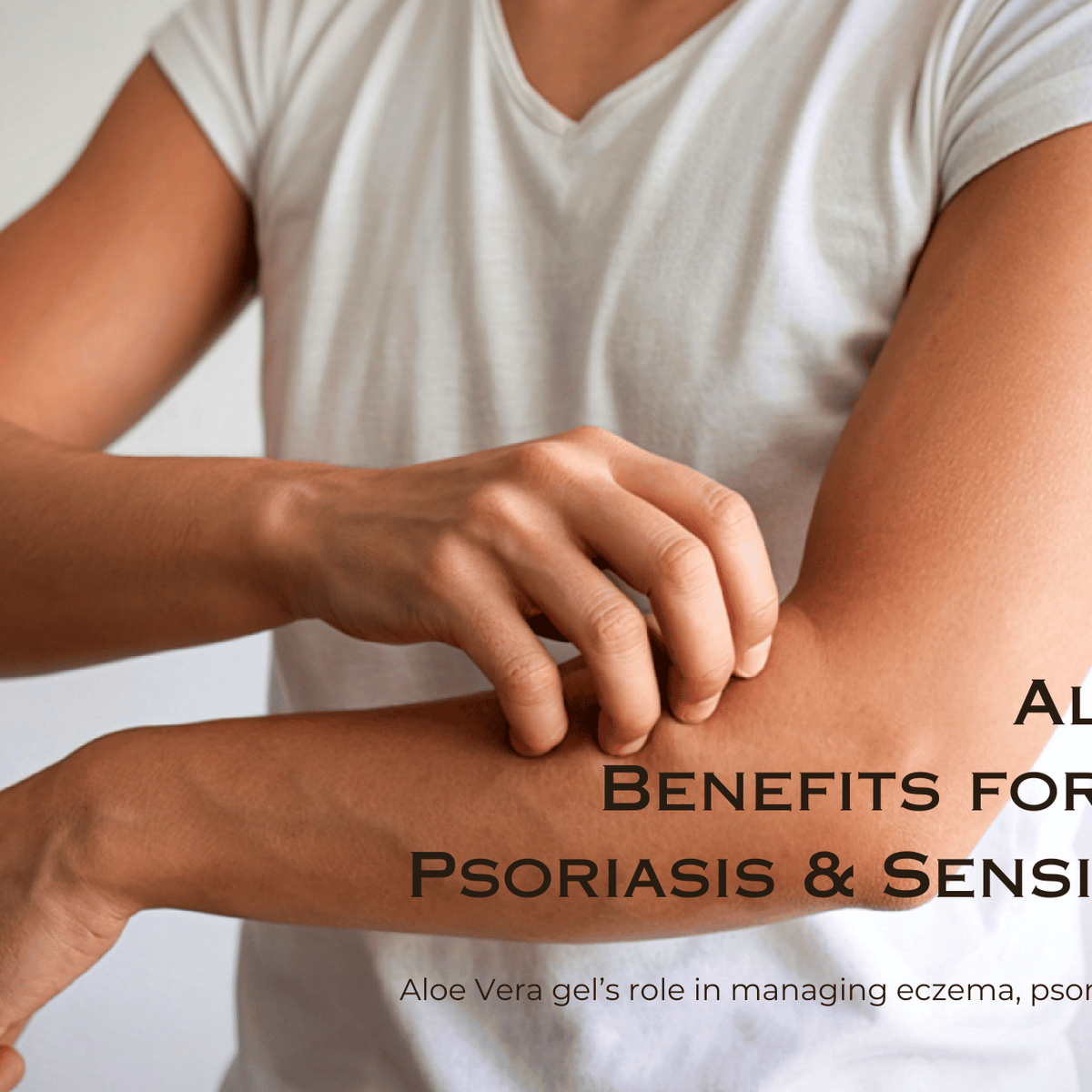Aloe Vera Gel for Eczema, Psoriasis & Sensitive Skin: Benefits & Limits